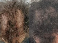 Hair+24