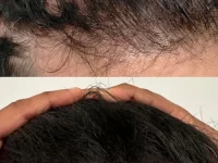 Hair+9